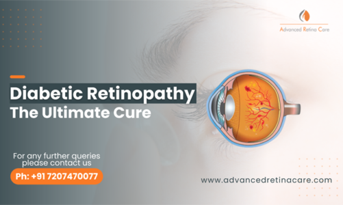 Diabetic Retinopathy – The Ultimate Cure!